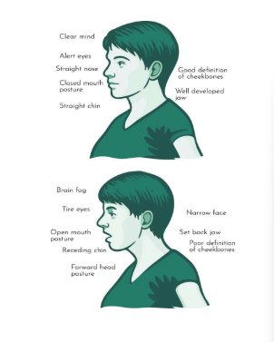 Myofunctional Therapy